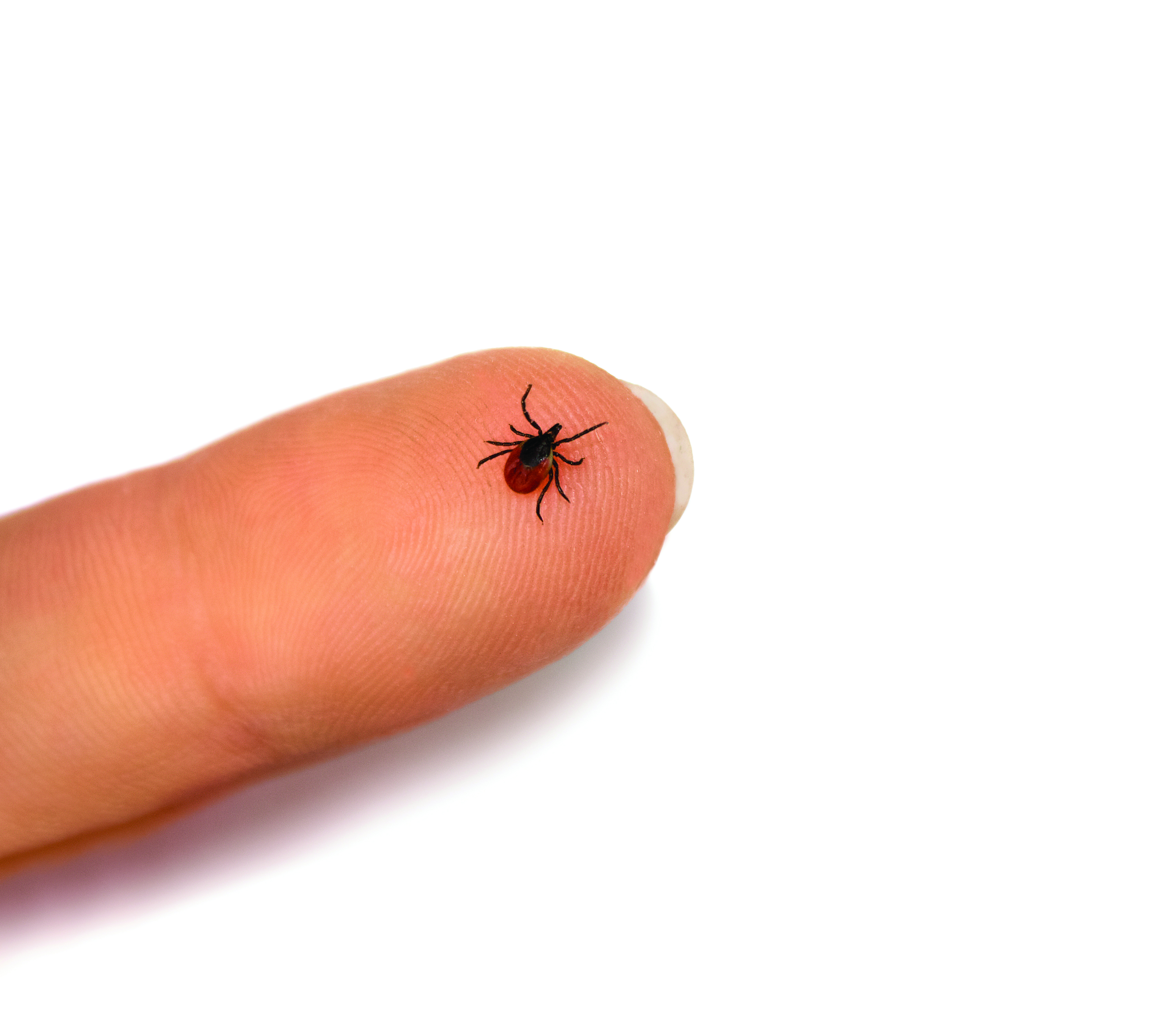 How Do I Know if I Have Lyme Disease?