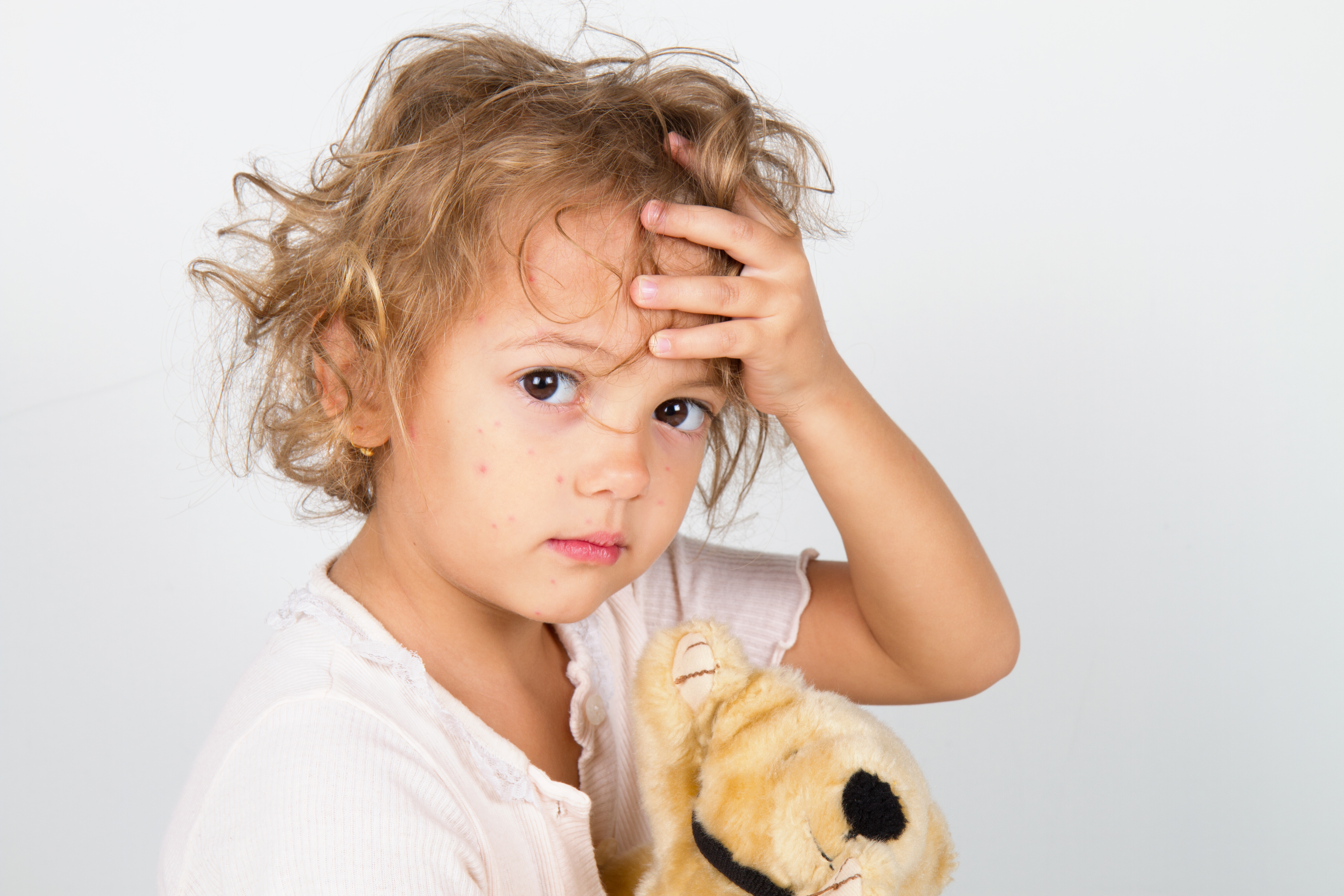 Natural Remedies for Common Childhood Ailments: Part Two