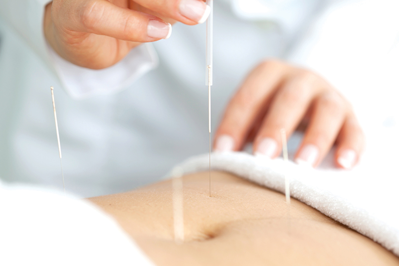 Increased Fertility Through Acupuncture!