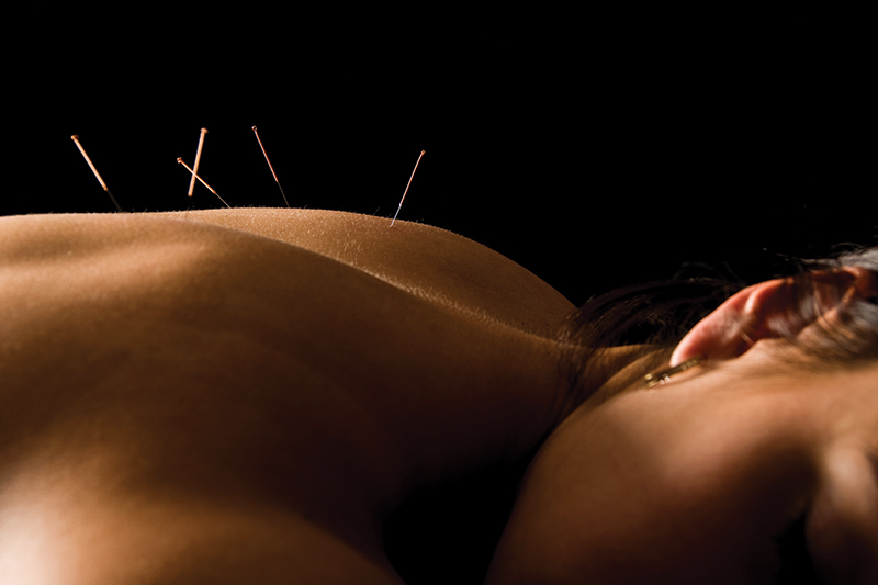 Acupuncture Is Much More Than Pain Relief