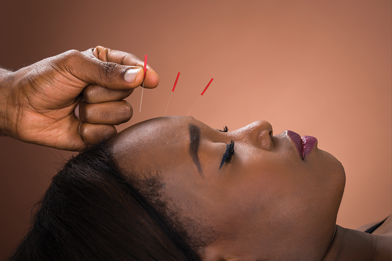 The Energetics of Acupuncture