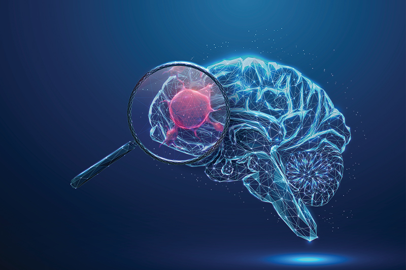 Understanding the Culprits of Neurologic Conditions: Lyme Disease, Infections, and Toxins