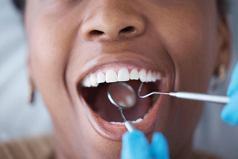 What Does Holistic Dentistry Really Mean?